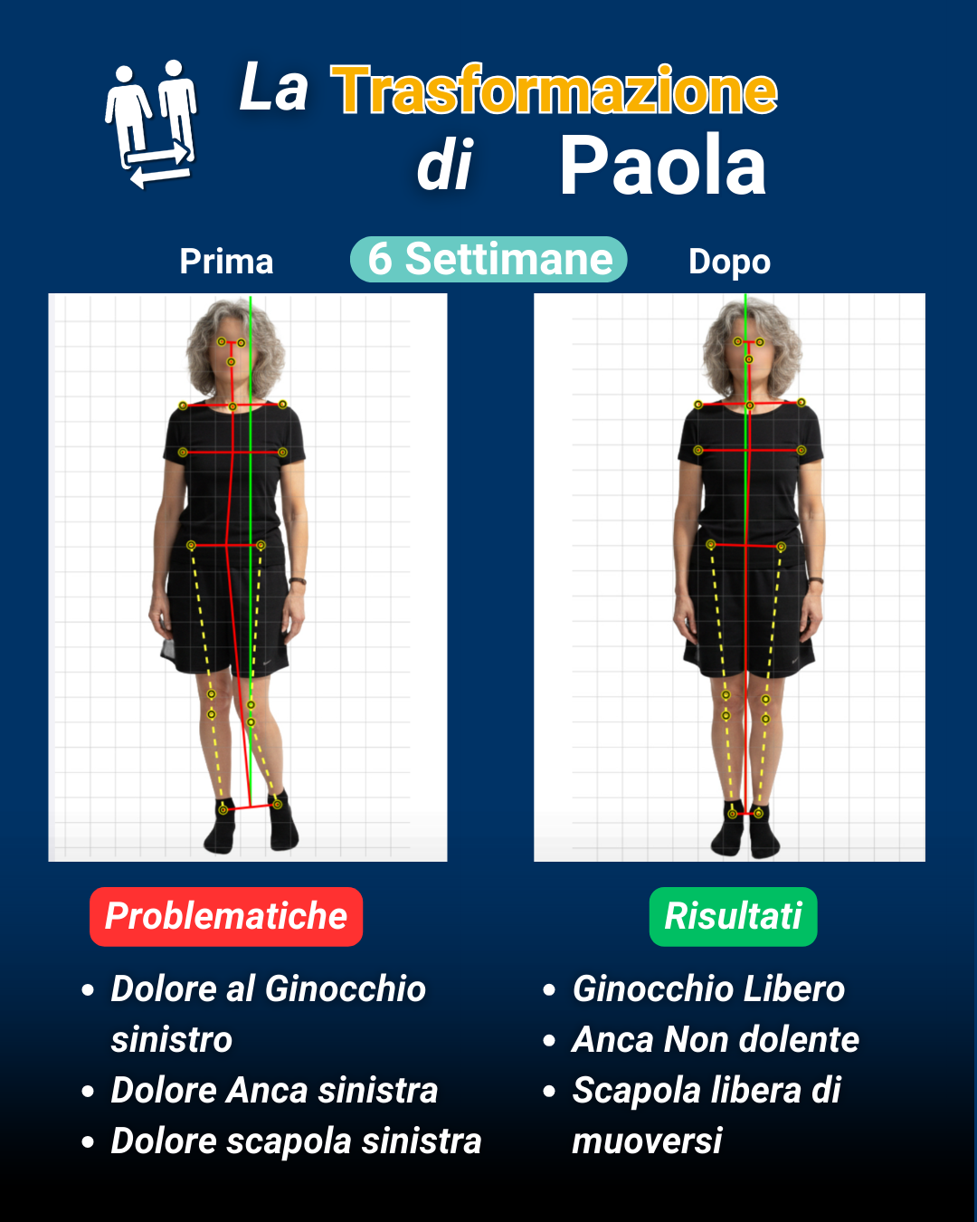 Trasformazione Paola: dolore ginocchio, anca, scapola risolti in 6 settimane