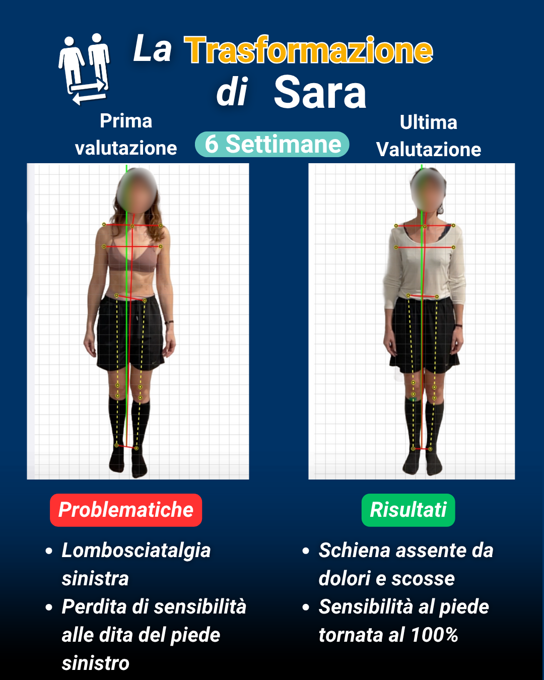 Trasformazione Sara: lombosciatalgia e perdita sensibilità risolte in 6 settimane